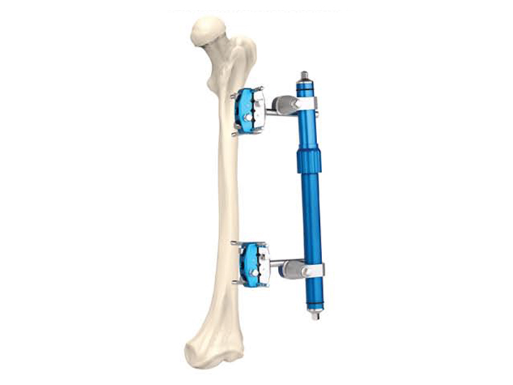 Femoral fixator