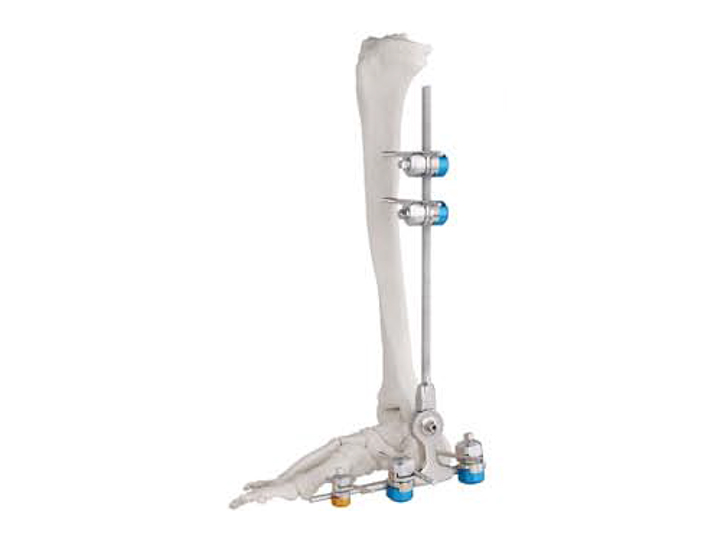 Ankle fusion joint fixator