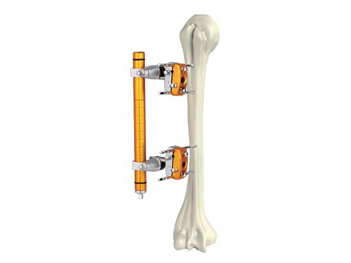 Humeral shaft fixator