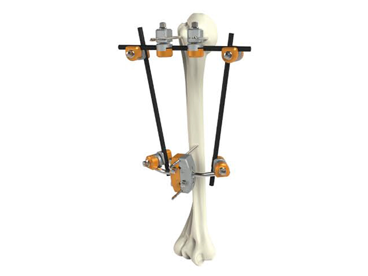 Proximal humerus fixator
