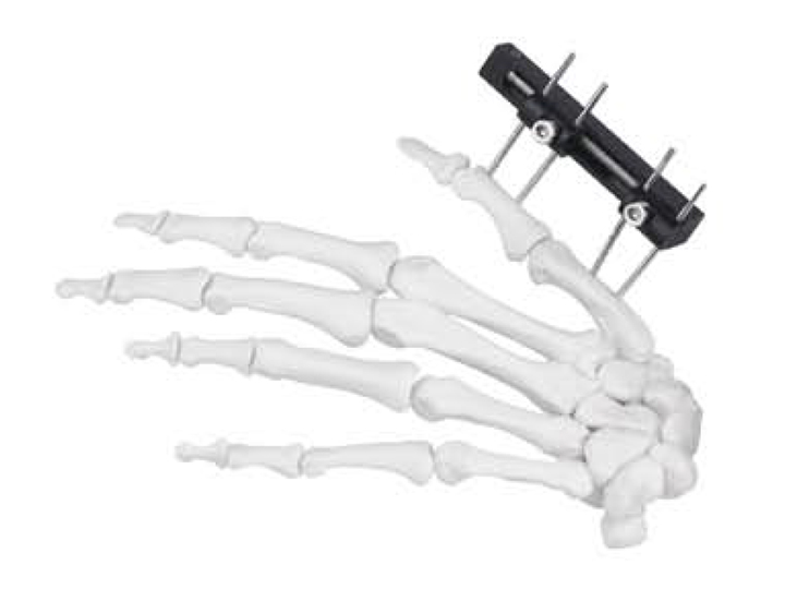 Minirail lengtheners