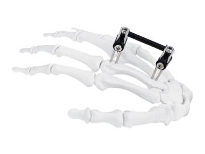 Mini fixator C type