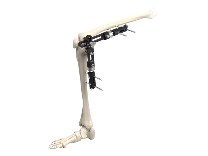 Knee joint external fixator