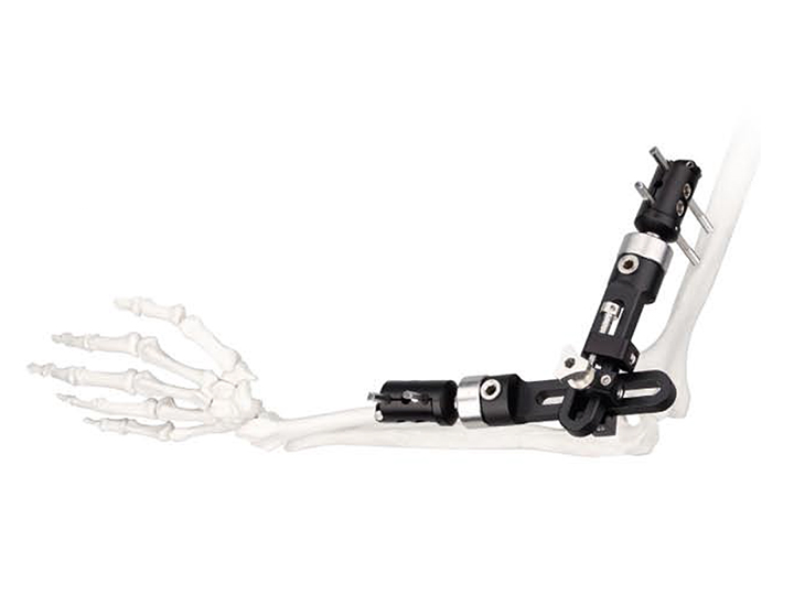 Elbow joint external fixator
