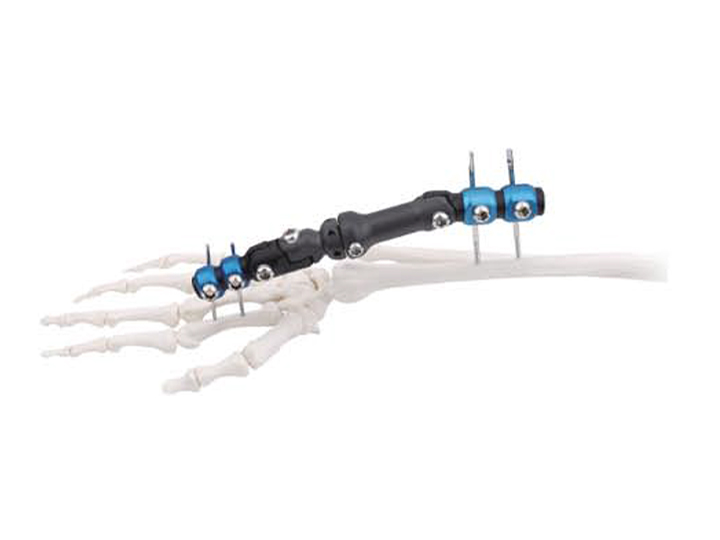 Wrist external fixator (radiolucent multi-joint type)