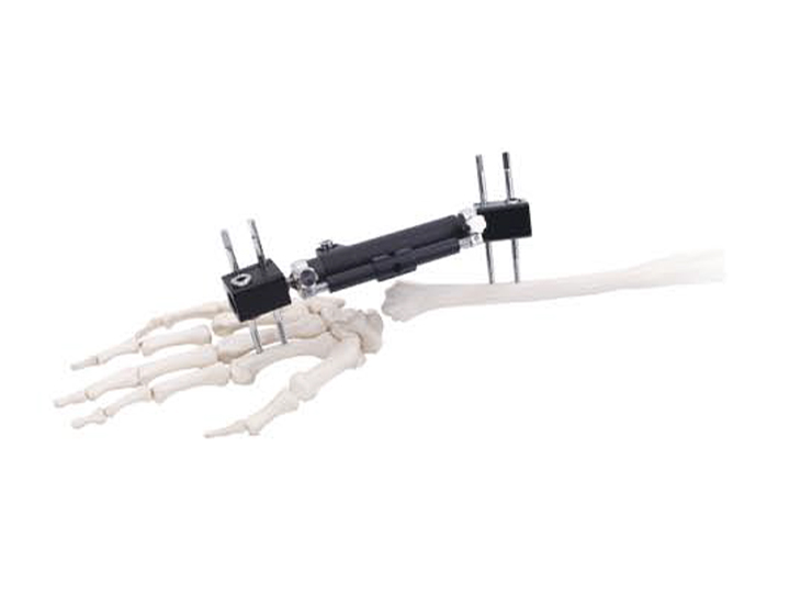 Wrist external fixator (radiolucent type)