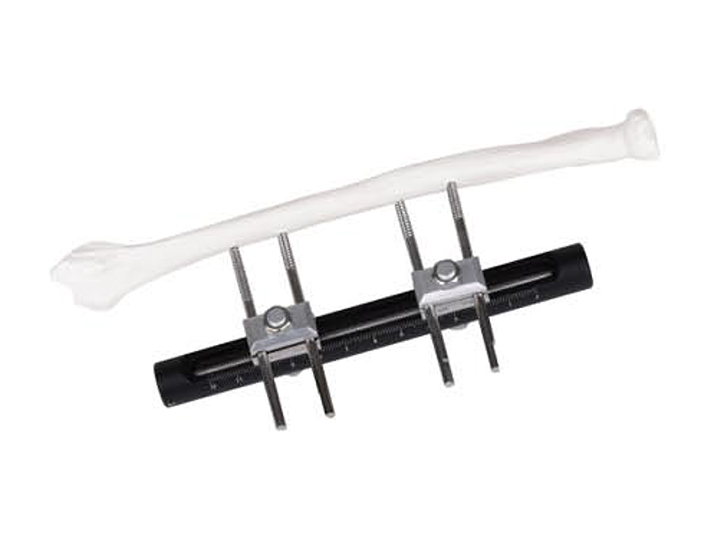 forearm external fixator