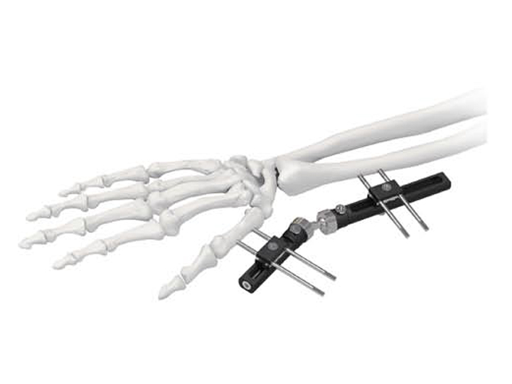wrist external fixator (straight type)