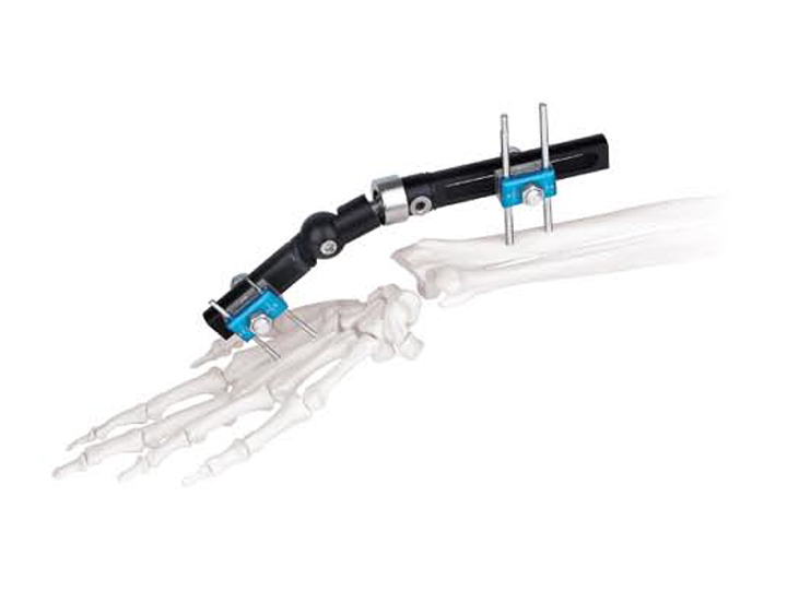 Wrist external fixator (half ball connection type)