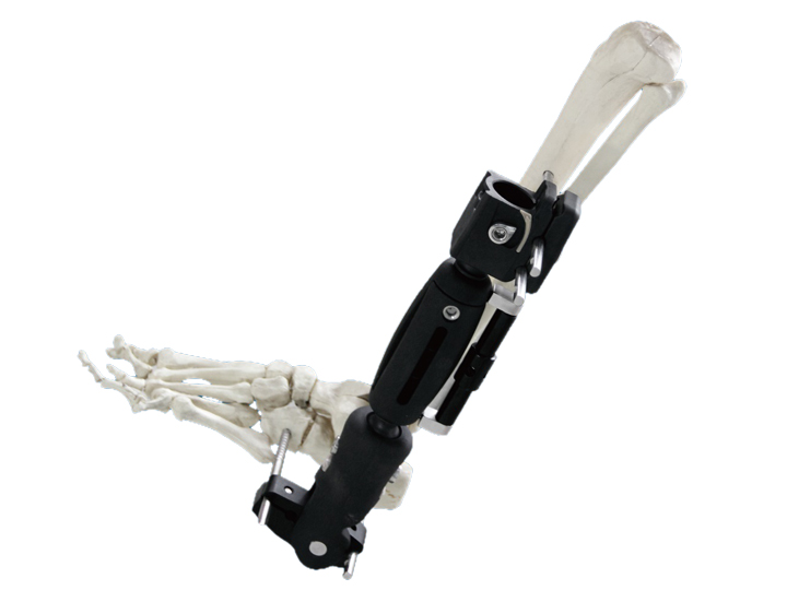 Radiolucent ankle kit