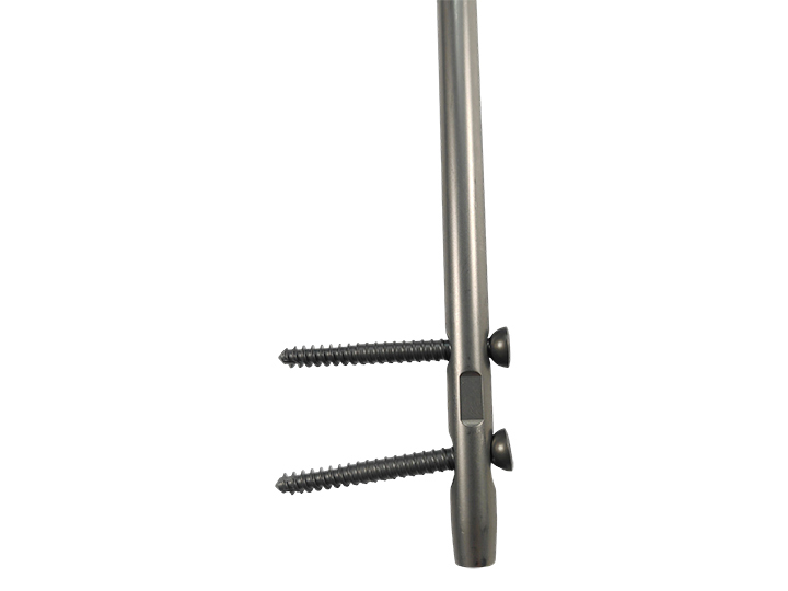 Expert femur intramedullary nails