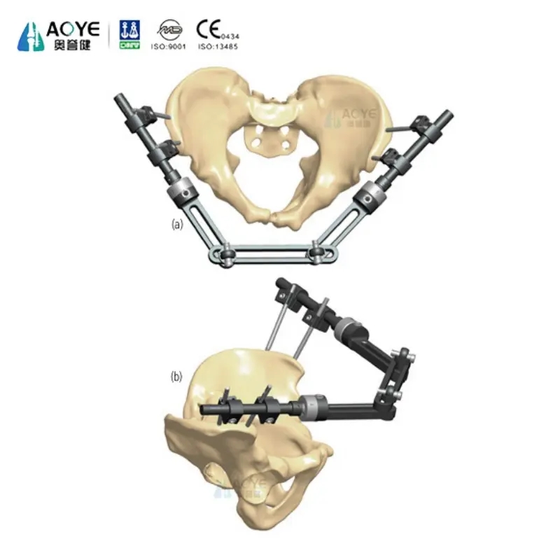 Pelvic Exyernal Fixator-Three Section Type