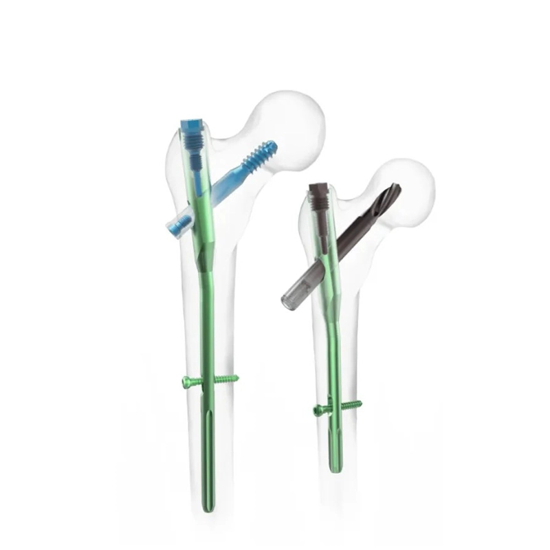 PFNA Intramedullary Nail | Titanium Proximal Femoral Implant