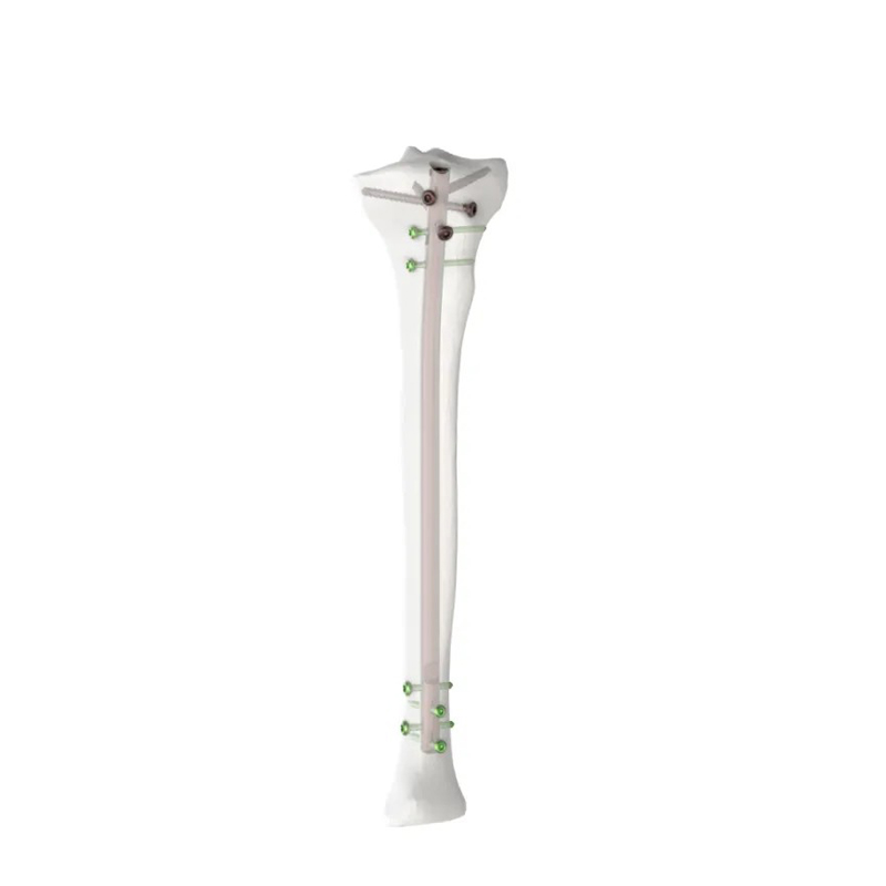 Expert Tibia Intramedullary Nail | Titanium Orthopedic Implant